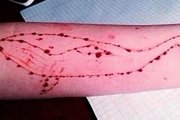 Senado aprova lei que criminaliza desafios que levam à automutilação