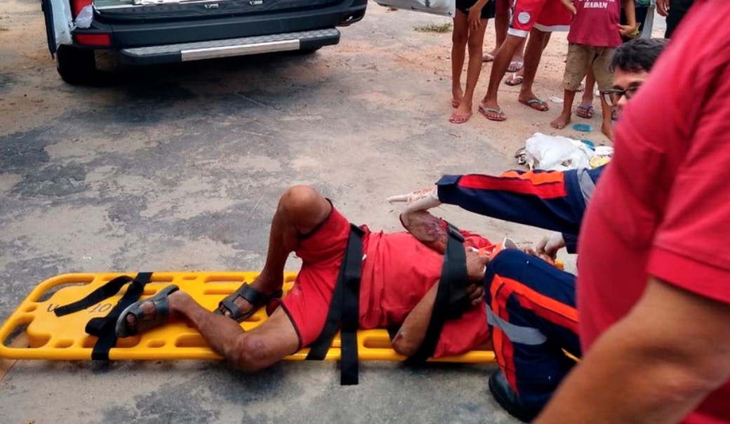Em Manaus, morador de rua morre ao ser atropelado por caminhão enquanto dormia