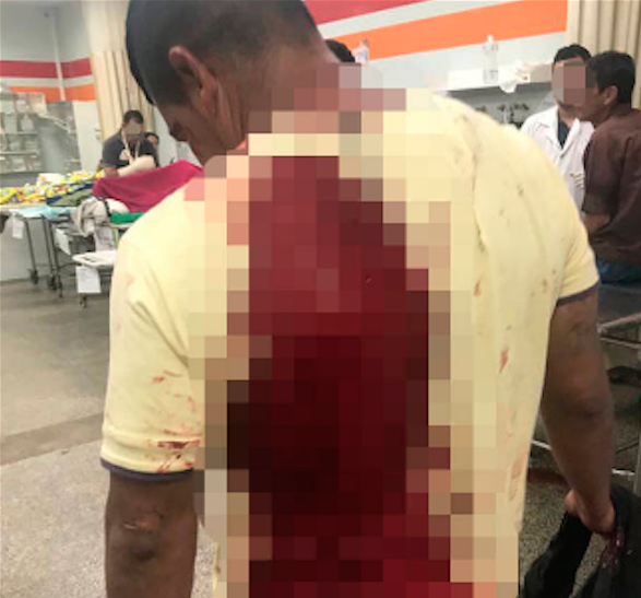 Passageiro é esfaqueado durante assalto a ônibus em Manaus