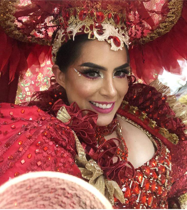 Sinhazinha da Fazenda do Boi Garantido sofre acidente de carro em Manaus