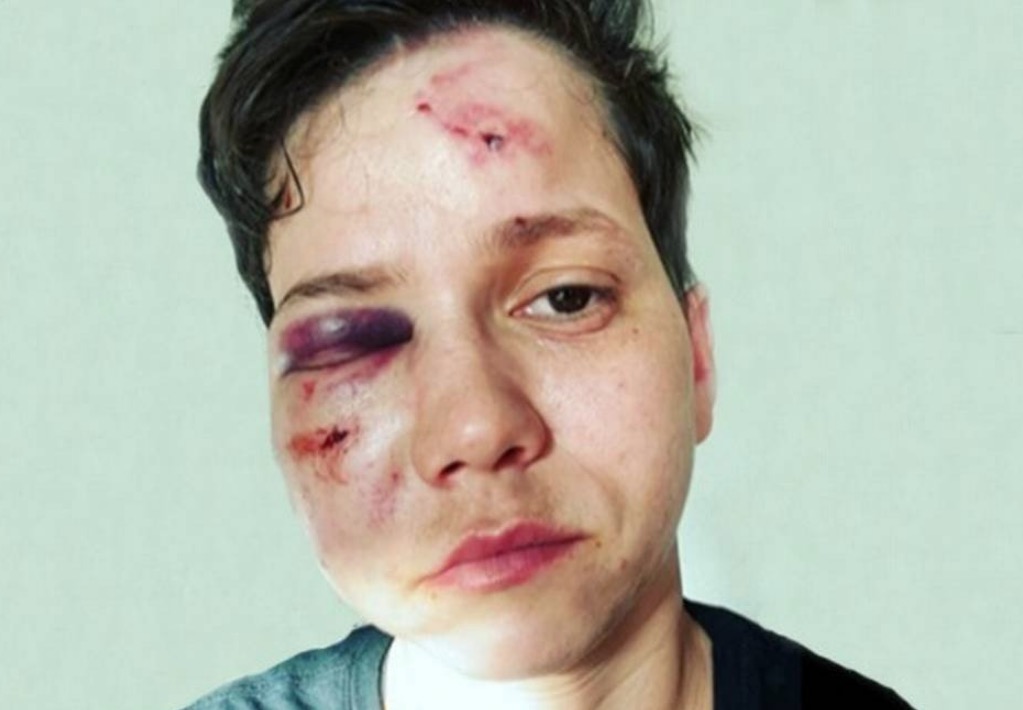 Youtuber bolsonarista é espancada até desmaiar durante passeio com a namorada 