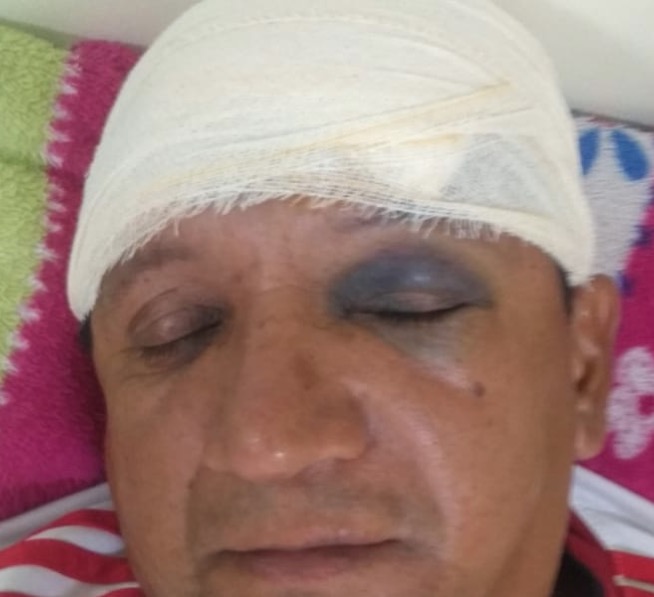 Em Manaus, vizinho irado invade loja e espanca dono com barra de ferro na frente dos filhos