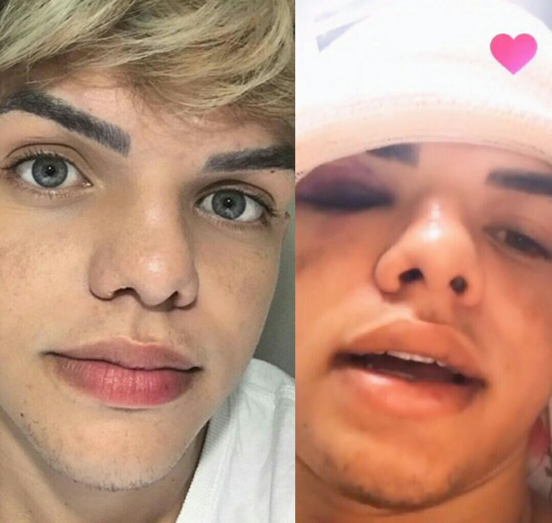 Youtuber sofre grave acidente de carro: 'Me deu mais uma oportunidade'