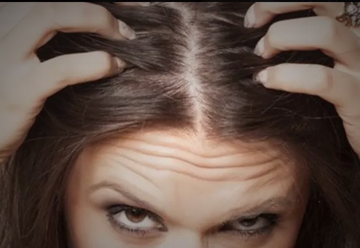 Veja mitos e verdades sobre queda de cabelo e fique atento