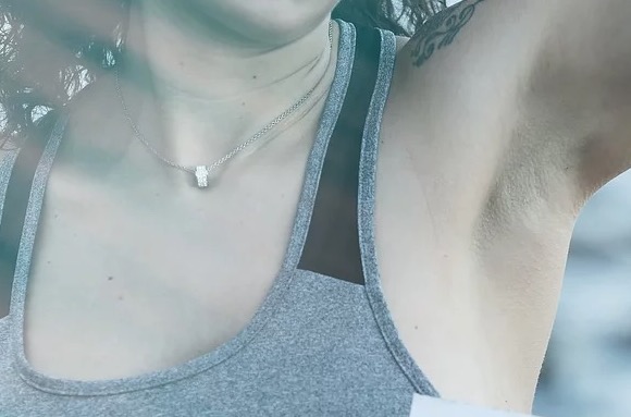 Saiba como acabar com o suor excessivo e odor das axilas