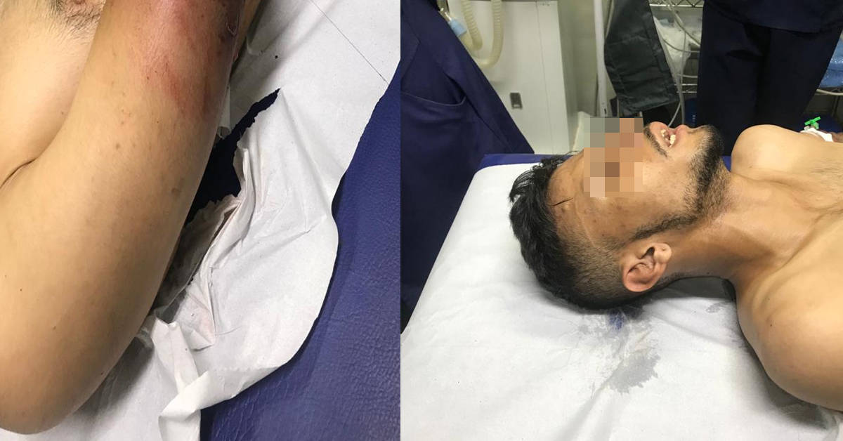 Suspeito de arrastão é baleado ao trocar tiros com a polícia em Manaus 