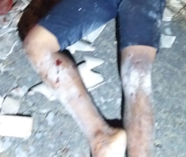 Apedrejado, homem é encontrado morto em verdadeira cena de terror em Manaus