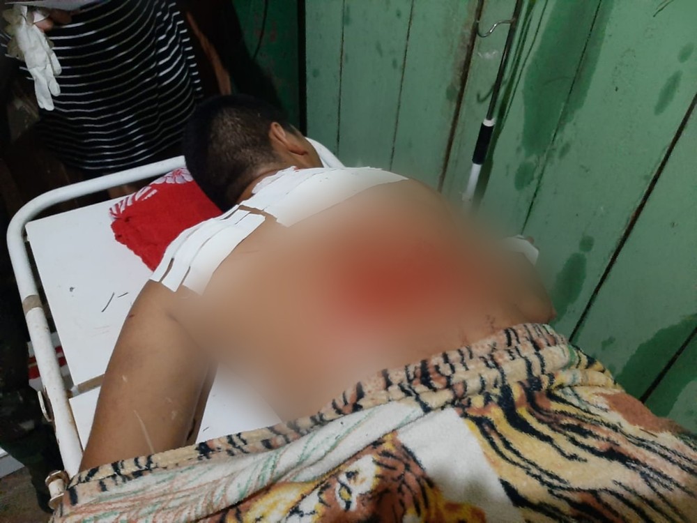  Durante confronto, cabo do Exército cai em rio e tem costas dilaceradas por hélice de barco