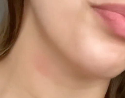 Fãs apontam ‘chupão’ em  pescoço de Vivian Amorim e ex-BBB explica