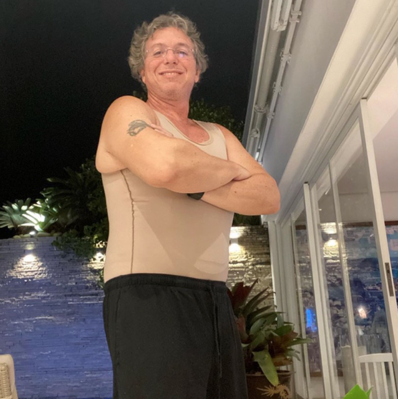 Diretor do BBB, Bonino faz cirurgia plástica após perder mais de 45 kg