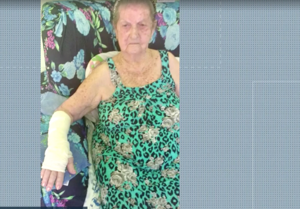 Idosa tem braço 'rasgado' ao tirar gesso em hospital