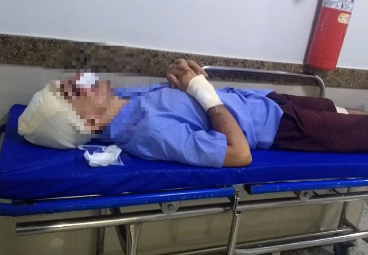 Em Manaus, motorista de ônibus é espancado a pauladas durante tentativa de assalto