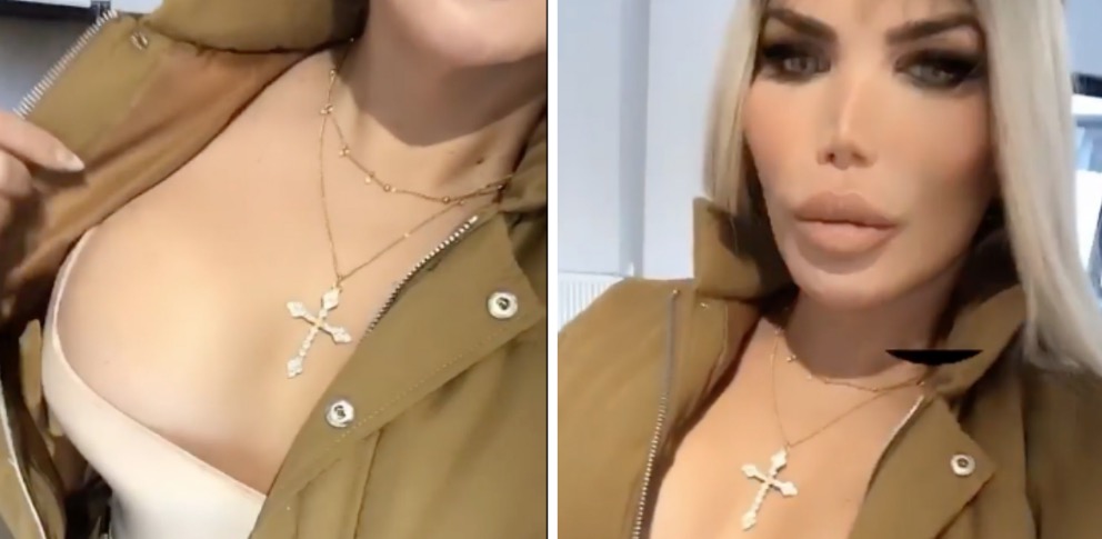 Ex-Ken Humano exibe resultado de silicone nos seios após anunciar transição de gênero