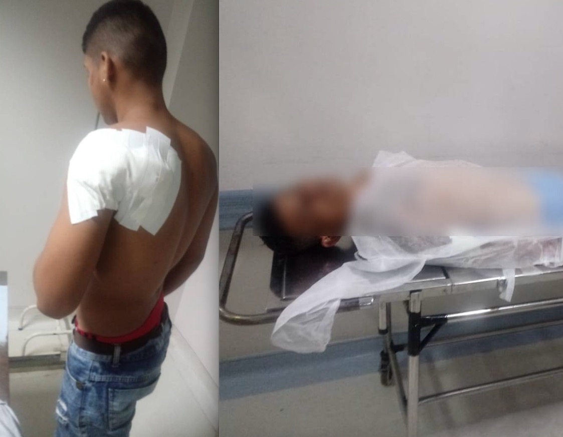 Dupla é baleada durante tiroteio em rua de Manaus