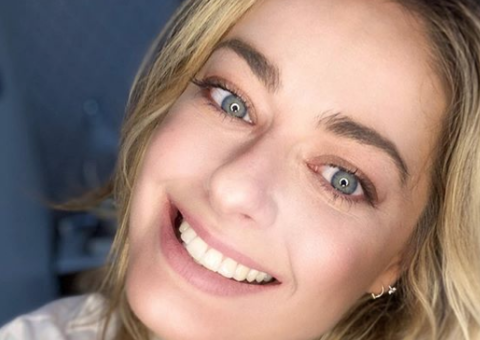 Após acidente, vencedora do MasterChef fica com rosto desfigurado e desabafa na web