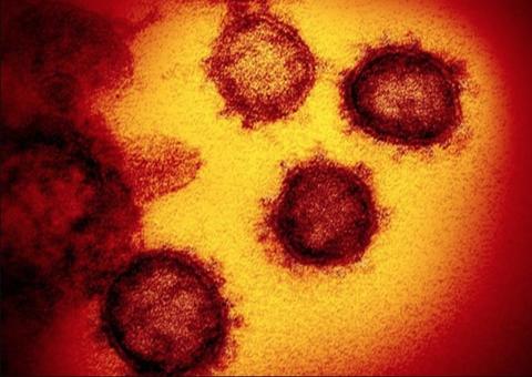 Brasileiro com coronavírus se reuniu com 30 familiares; média de infecção é de mais três pessoas