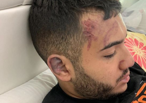 Em Manaus, Casa das Correias demite funcionário envolvido em espancamento de estudante