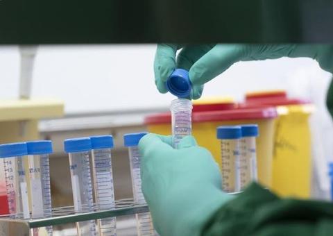 Ministério da Saúde confirma terceiro caso do novo coronavírus no país