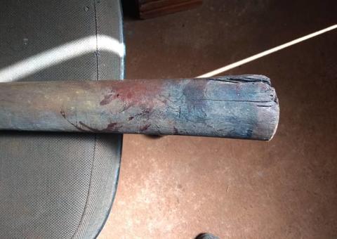 Inconsciente, jovem vai parar em hospital após levar paulada de esposa em Manaus