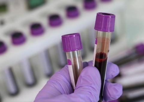 Deputada iraniana morre após ser contaminada por coronavírus