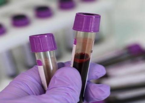 Sobe para 36 o número de infectados com coronavírus no Brasil; RS confirma segundo caso