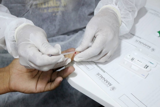 Casos de sífilis em Manaus têm aumento de quase 2 mil