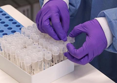 Guiana registra primeira morte por coronavírus