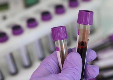 Mais de 2 mil médicos e enfermeiras pegaram vírus na Itália