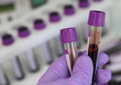 Amazonas deve receber mais de 200 kits para testes do novo coronavírus 