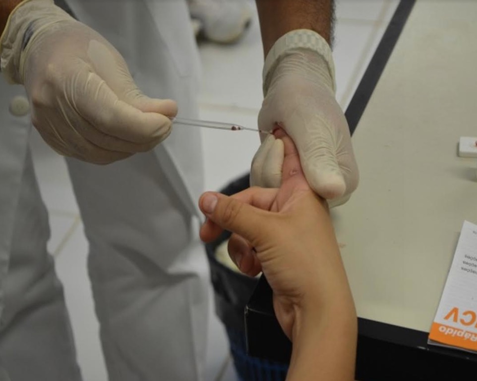 FVS alerta população para identificar tuberculose durante a pandemia de coronavírus