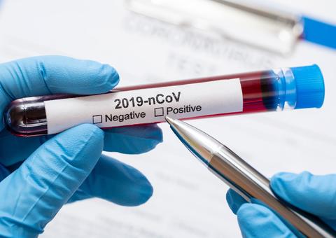 Coronavírus: Diretor de Emergência em Saúde da Espanha testa positivo 