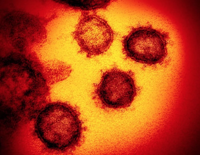 Pesquisadores descobrem anticorpos que podem combater coronavírus 