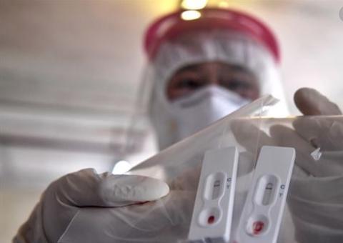 Brasil fará teste em massa neste mês para saber número de infectados por coronavírus