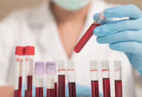 Familiares de índia infectada fazem exames para coronavírus no Amazonas