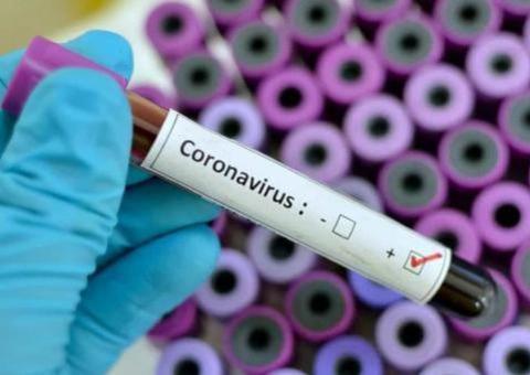 Amazonas registra cinco mortes confirmadas por coronavírus