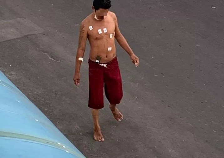  Internado com Covid-19, morador de rua foge de hospital em mototáxi no Amazonas