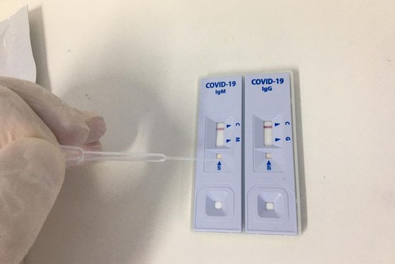 Ufam realiza testes rápidos para controle da Covid-19 em profissionais da saúde 