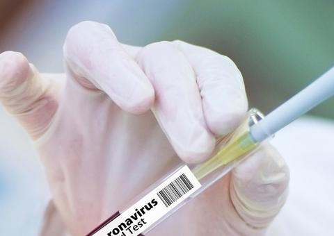 Pesquisadores de Manaus são perseguidos após estudo com cloroquina em pacientes de Covid-19