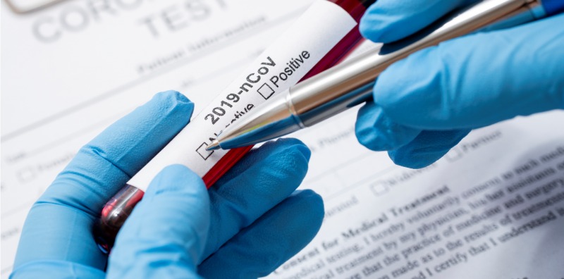 Ministério da Saúde envia mais 8 mil testes de Covid-19 para o Amazonas