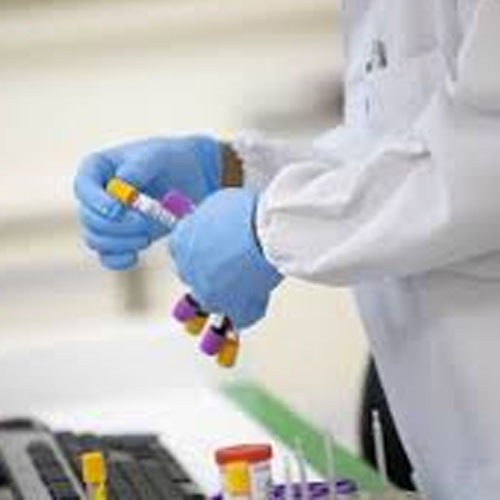 Ao menos 182 brasileiros se oferecem para contrair covid-19 e testar vacina 