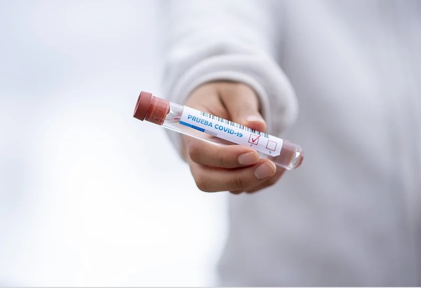 Anvisa aprova testes rápidos para covid-19 em farmácias