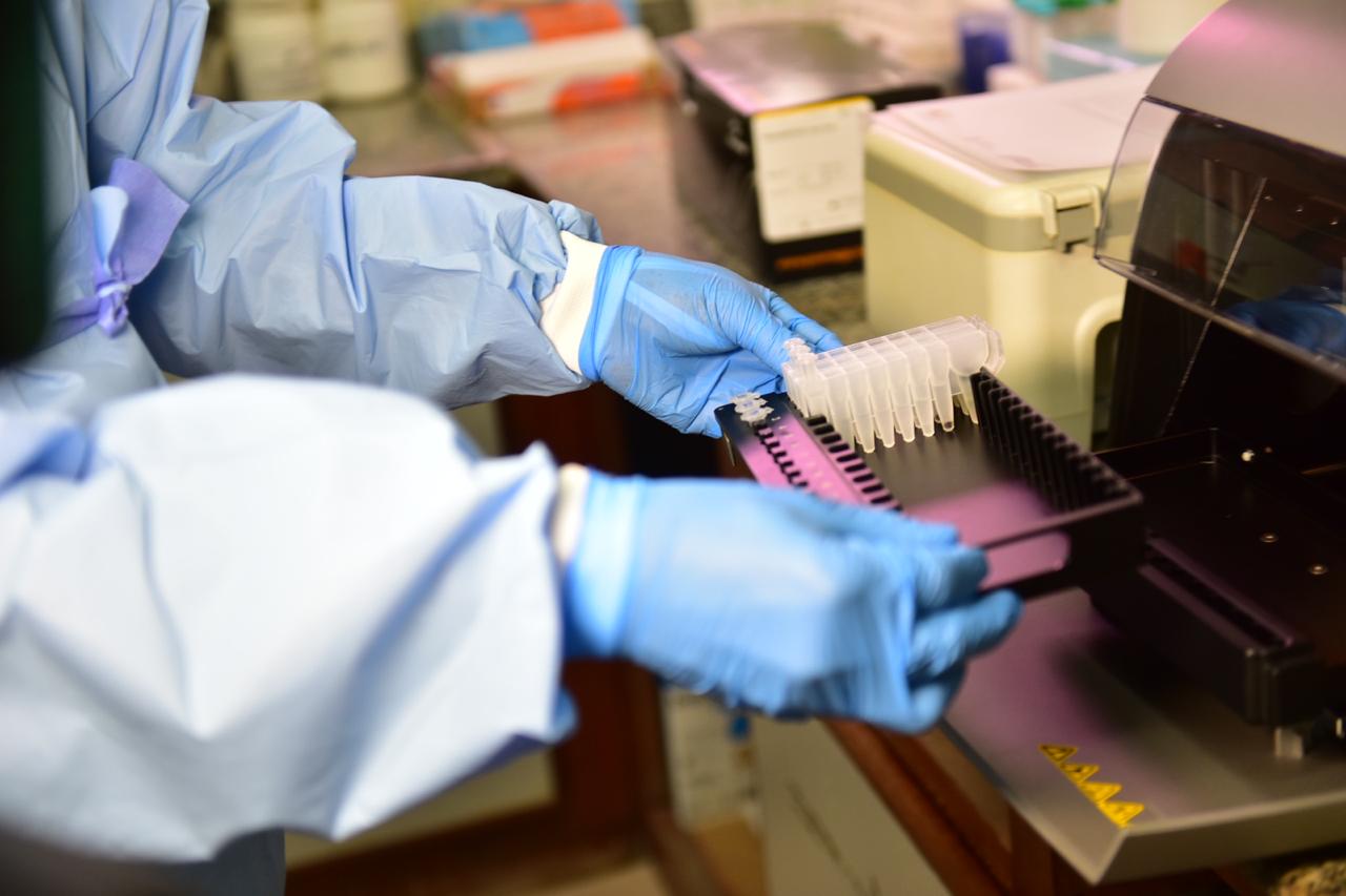 Mais exames e testes refletem em explosão dos casos de Covid-19 no Amazonas