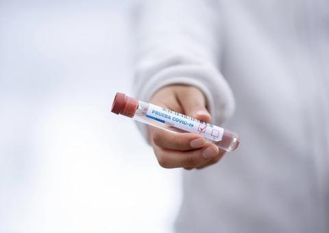 Covid-19: Brasil atinge 12.400 mortes e 177.589 casos confirmados