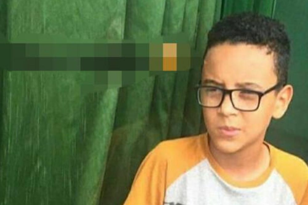 É grave o estado do menino baleado na cabeça na frente de igreja em Manaus