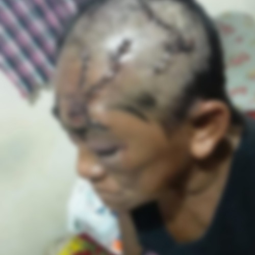 Mulher tem rosto desfigurado após ser atacada por ex-genro em Manaus