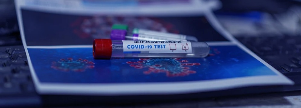 Hospital Albert Einstein cria teste para detectar coronavírus em larga escala, desde 1º dia da infecção 