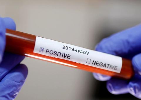 Brasil bate recorde e registra 1.188 novas mortes por coronavírus; total passa de 20 mil