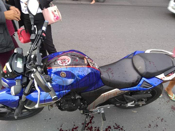 Mulher que foi degolada por linha de cerol morre em hospital de Manaus