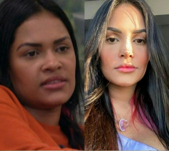 Ex-BBB Flayslane mostra resultado de cirurgia no nariz  