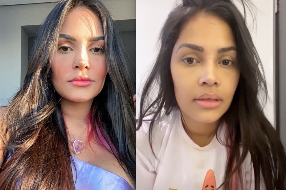 Novo visual de Flay, do BBB20, após plástica dá o que falar: ‘mudou de rosto 3 vezes’ 